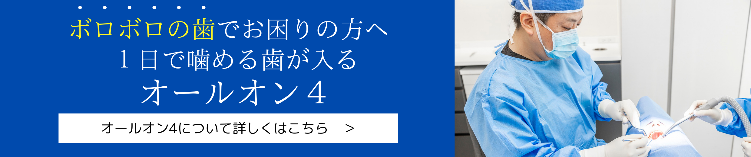 オールオン4バナー