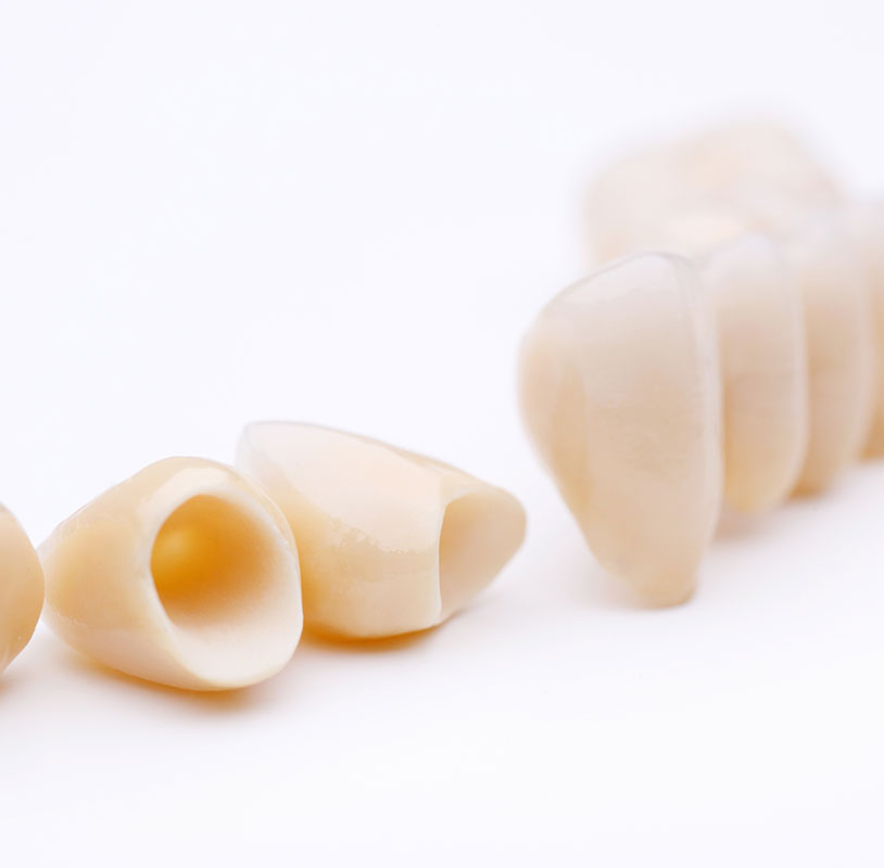 セラミック治療