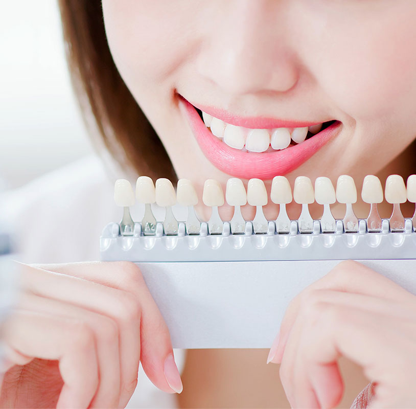 ホワイトニング