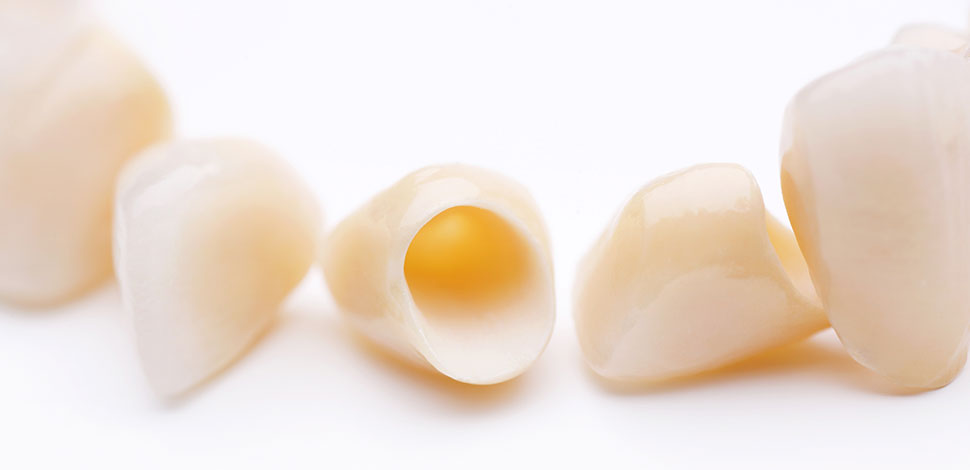 インプラントによる治療、審美治療の豊富な経験と実績