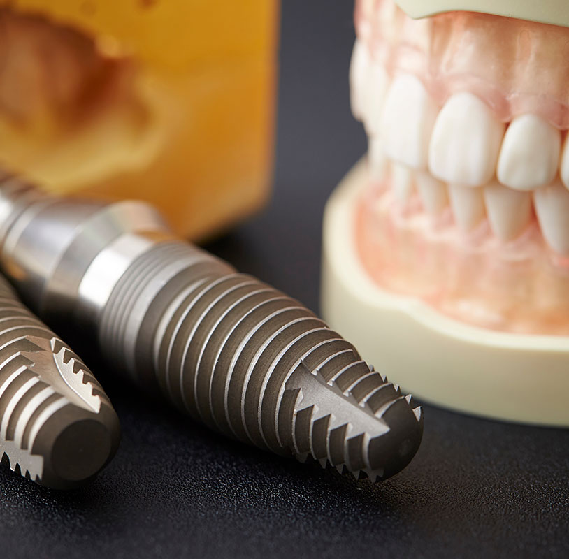 インプラントへの取組み