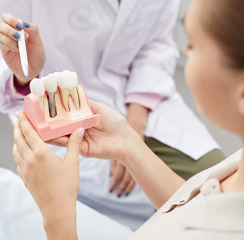 インプラントQ&A